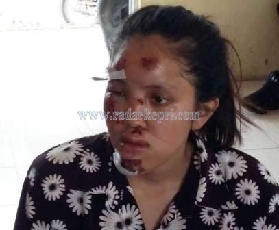 Imelda Dwi Bintani, mahasiswi Umrah yang menjadi korban penjambretan di Jl Engku Putri, Senin (20/04) dini hari.