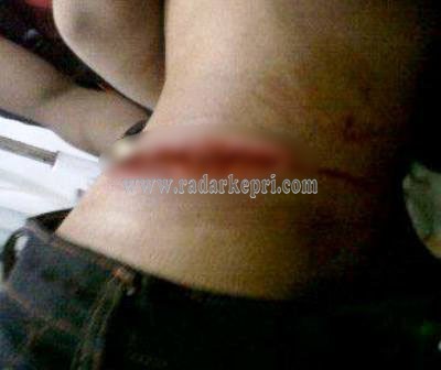 Lio Sarjan, korban pembacokan.
